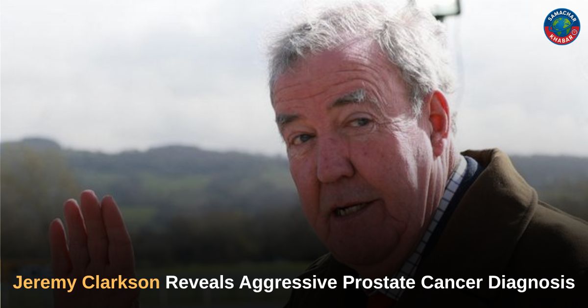 Jeremy Clarkson Reveals Aggressive Prostate Cancer Diagnosis
