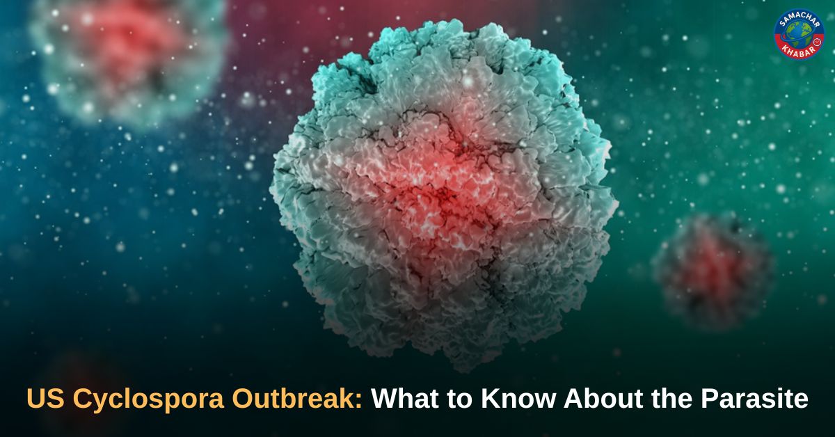 US Cyclospora Outbreak What to Know About the Parasite
